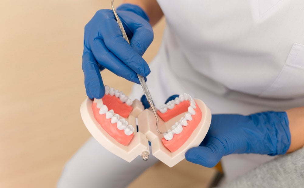 dentist showing something teeth model