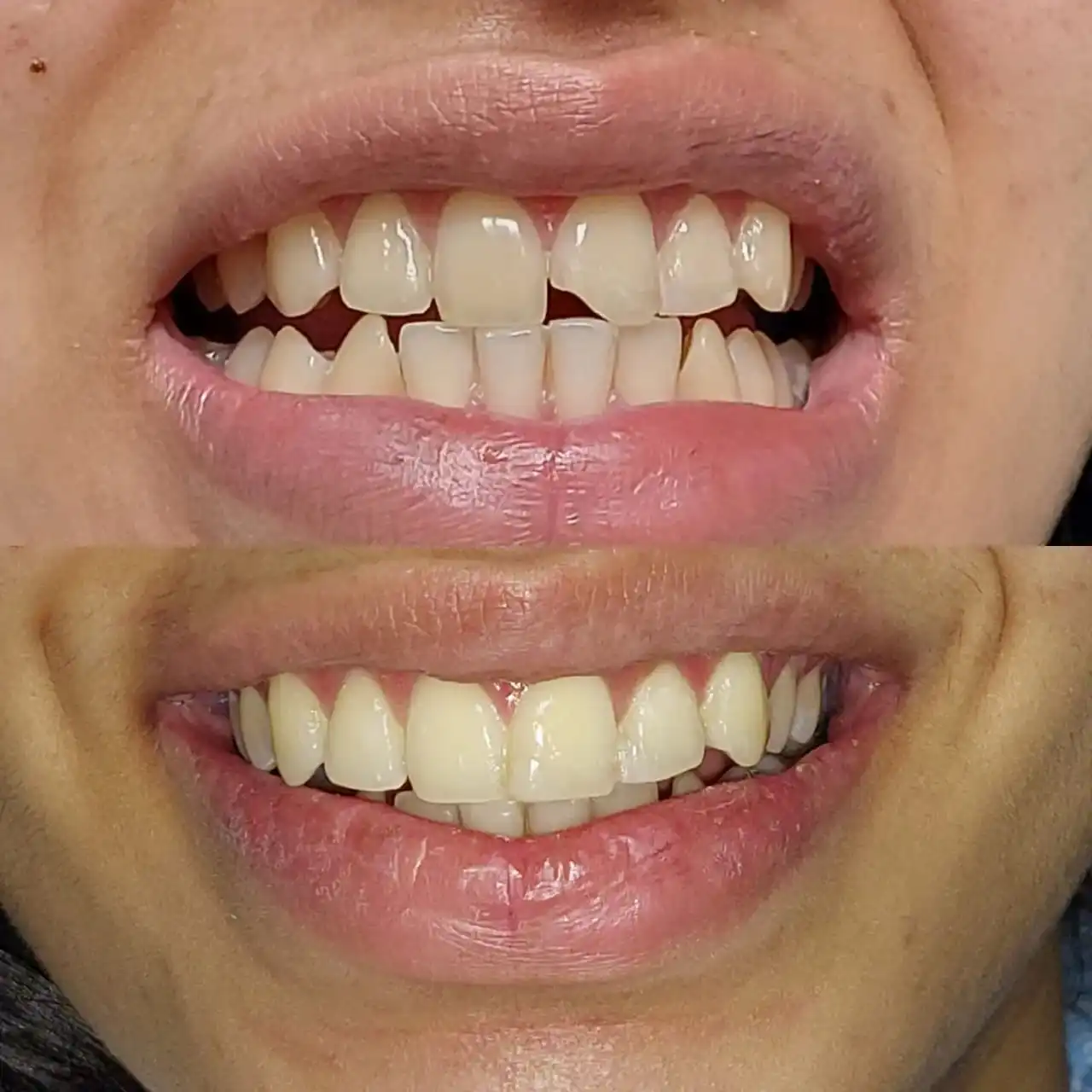 Cosmetic dentistry for smile transformation